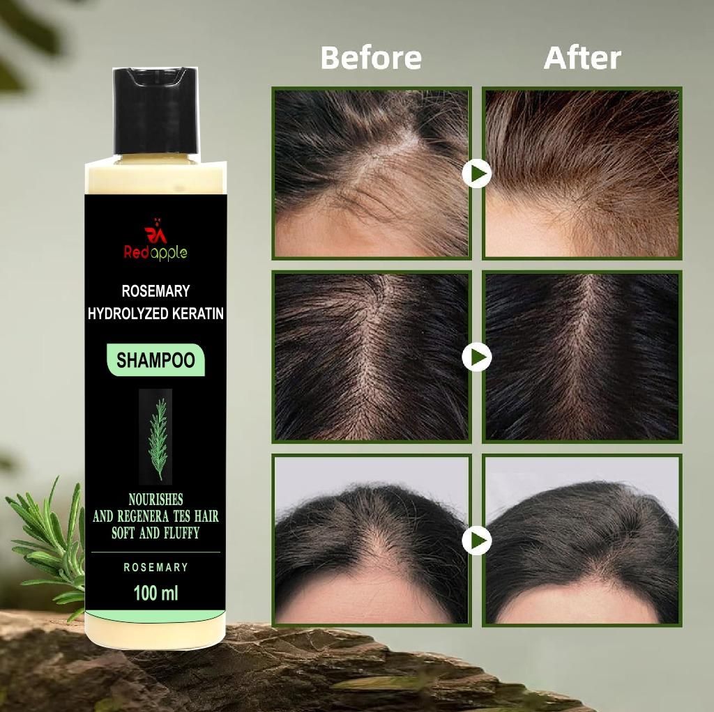 Rosemary Hydrolyzed Keratin Shampoo 100 ml Pack of 1